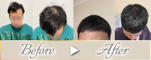 ビフォーアフター
