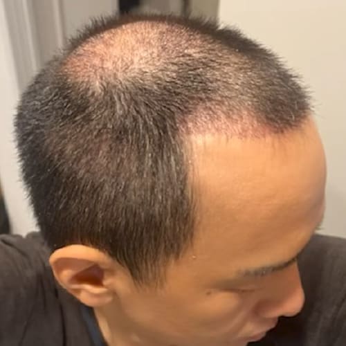 1ヶ月