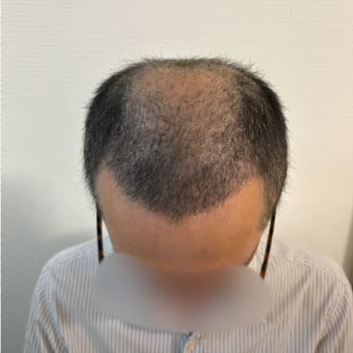 1ヶ月