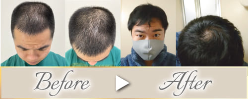 ビフォーアフター