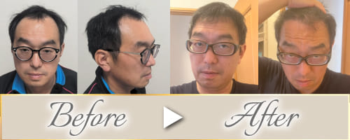 ビフォーアフター