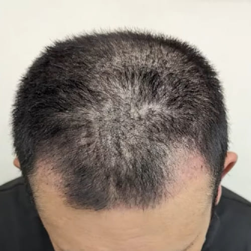 1ヶ月