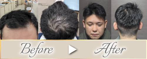 ビフォーアフター