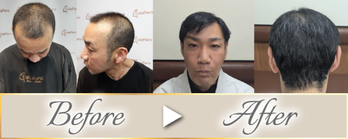 ビフォーアフター