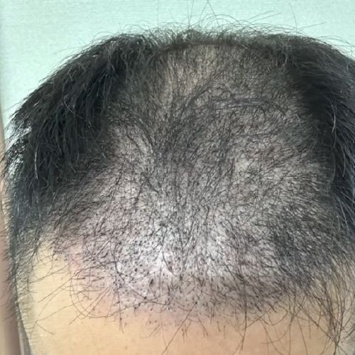 1ヶ月