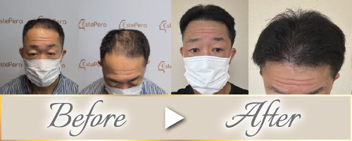 ビフォーアフター