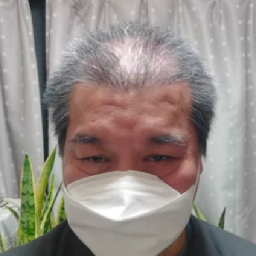 2ヶ月