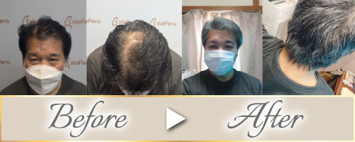 ビフォーアフター