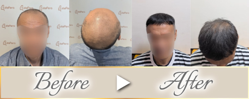 ビフォーアフター
