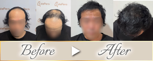 ビフォーアフター