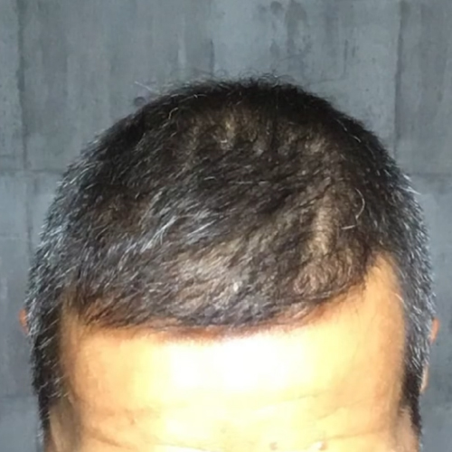 6ヶ月