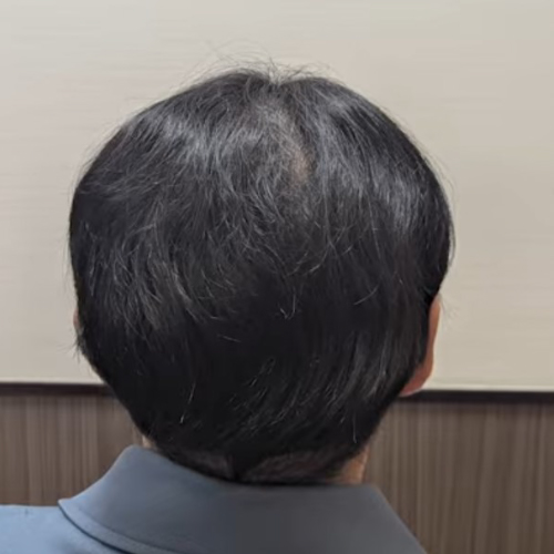 12ヶ月