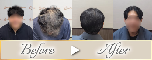 ビフォーアフター
